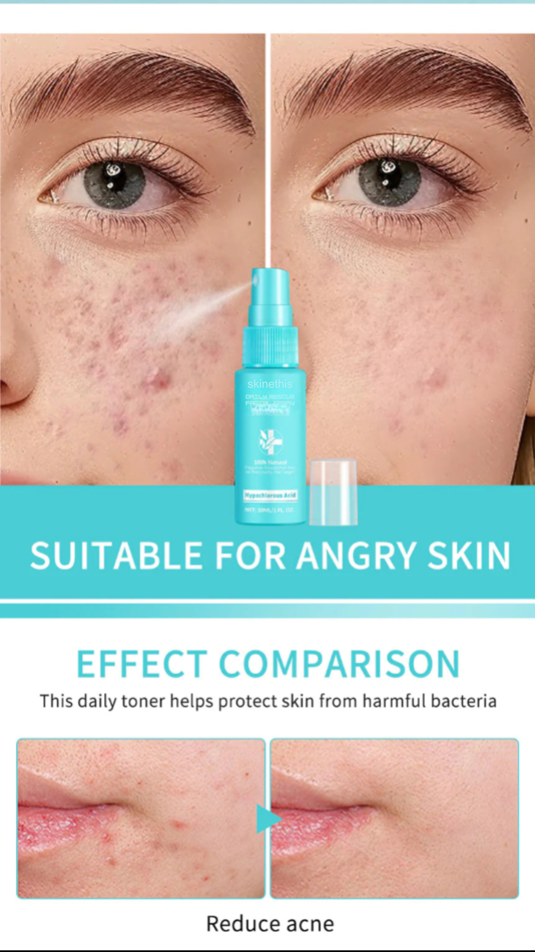 Skinethis Daily Rescue Spray
