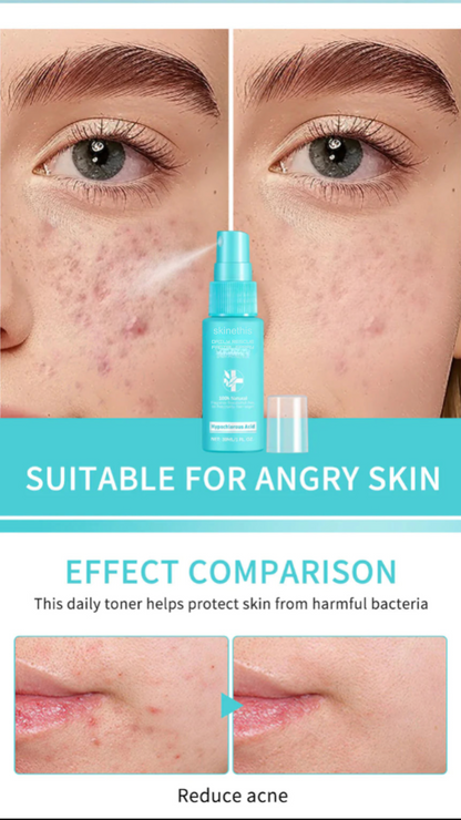 Skinethis Daily Rescue Spray